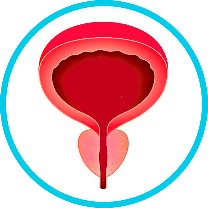 Präventioun vu Prostatitis